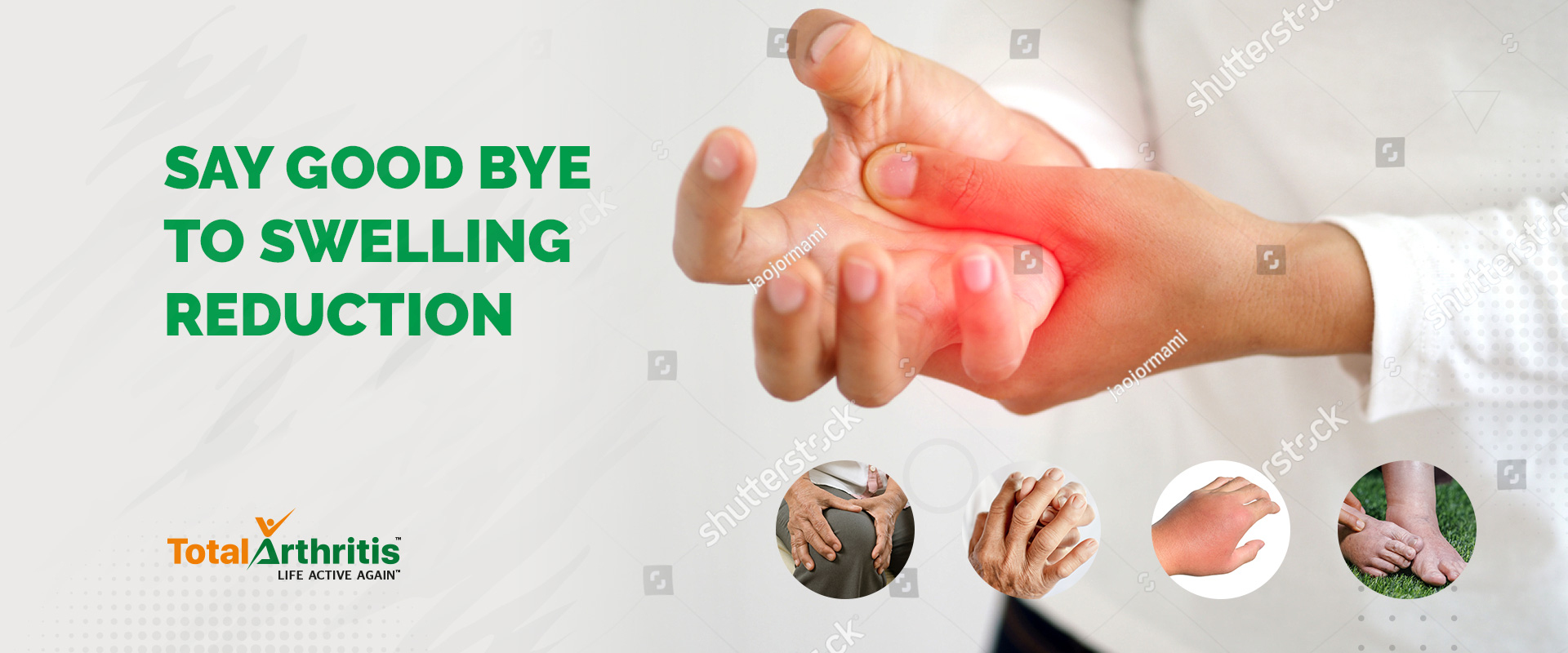 Understanding Swelling Total Arthritis