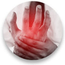 Psoriatic Arthritis