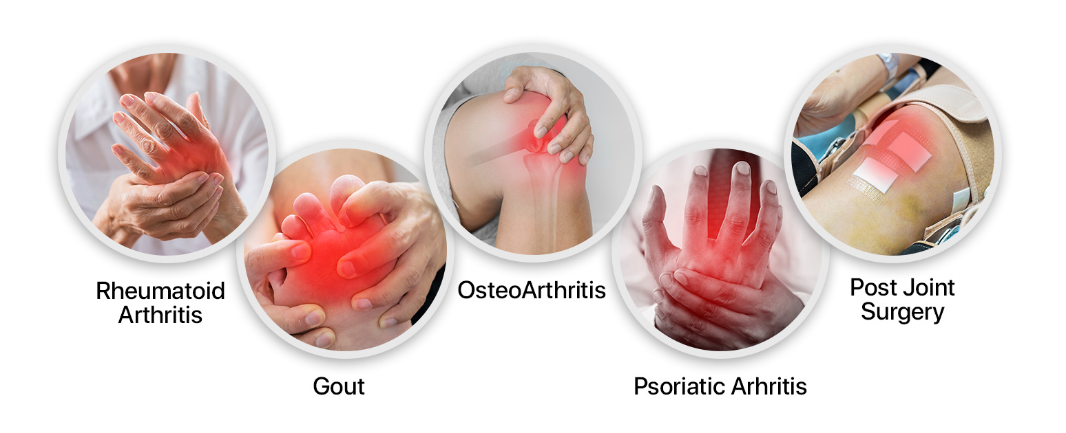 TotalArthritis Overview